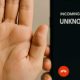 Une main qui indique qu'il ne faut pas répondre à l'appel commençant par 089